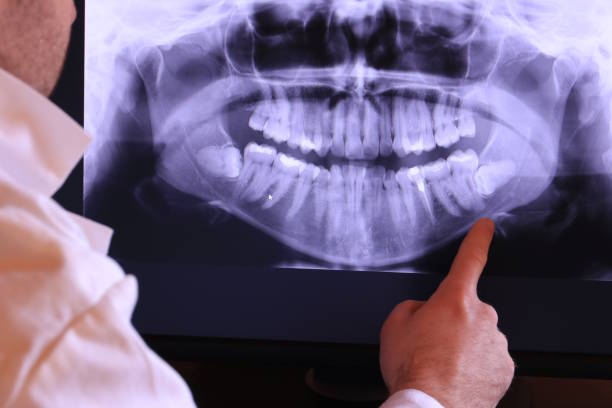 Best Emergency Dental Services for Seniors in Palm Harbor, FL